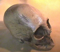 Human Skull, Homo sapiens, Peruvian with Cranial Binding